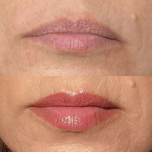 Before And After 2 - Permanent Lipstick From Dermaluxe Spa - Come To Dermaluxe Spa Today To Get Your Permanent Makeup Done
