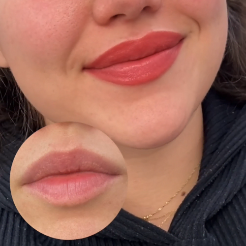Before And After 7 - Permanent Lipstick From Dermaluxe Spa - Come To Dermaluxe Spa Today To Get Your Permanent Makeup Done