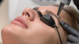 Microblading Removal in Houston Tx - Dermaluxe Spa Houston Texas - Get Permanent Makeup Tattoo Removal Done Today in Houston Texas