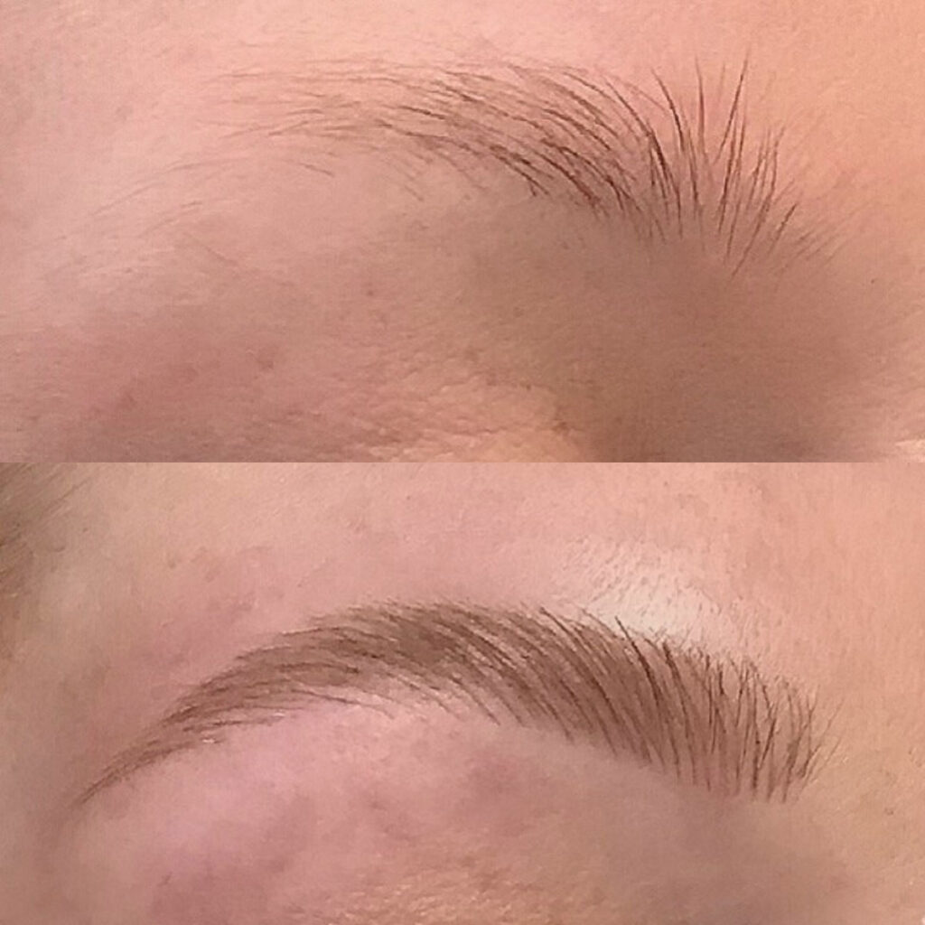 Best Natural Looking Microblading In Houston - Book Today At Dermaluxe Spa!